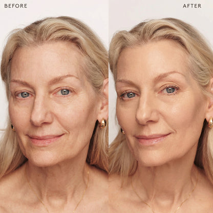 The simple solution for perfect skin