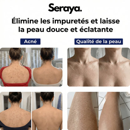 Serviette exfoliante antibactérienne