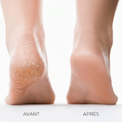 Des pieds lisses en 3 minutes